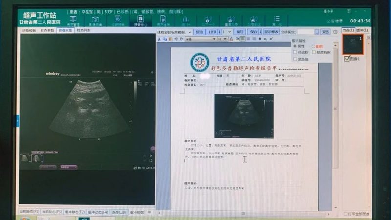 北京全身防癌体检套餐，揭秘防癌体检的奥秘